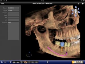 sidexis ix 300x225 1