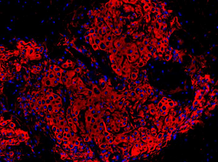 Stem cell manipulation shows promise for cartilage renewal and joint repair