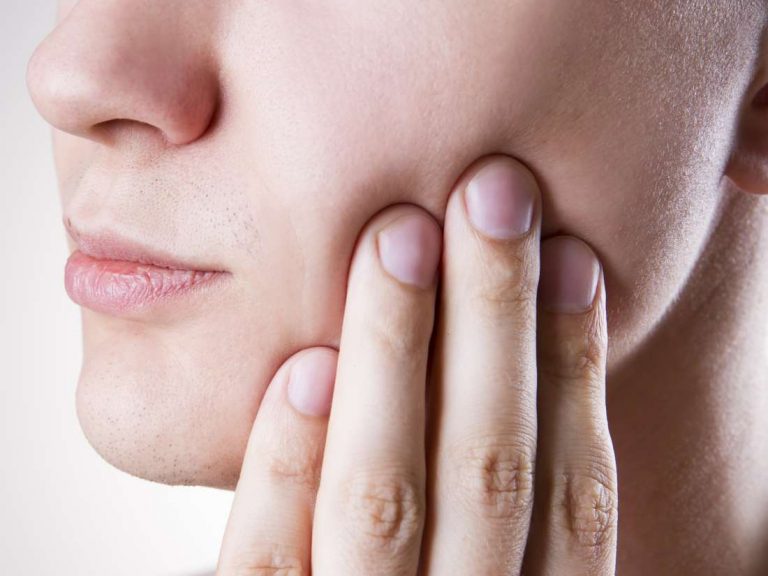 What causes pericoronitis?