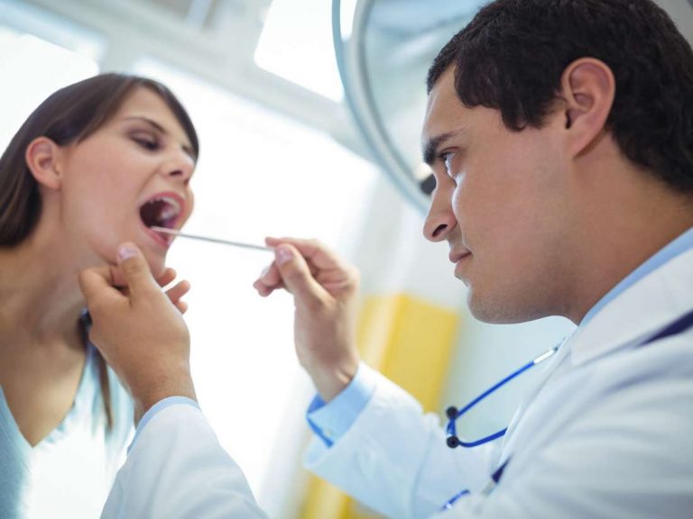 What you should know about hairy tongue